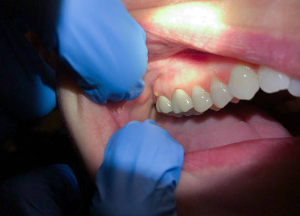 Best Emergency Dental Services for Seniors in Stafford Courthouse, VA
